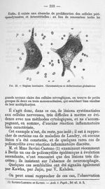 Fig. 23 - Région lombaire. Chromatolyse et déformation globuleuse - La poliomyélite épidémique (mala [...]