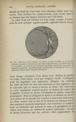 Fig. 31. - Un fond d'oeil normal - Myopie, hyperopie, astigmatisme