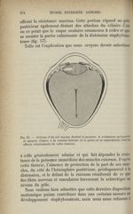 Fig. 57. - Schéma d'un oeil myope destiné à montrer la résistance qu'apporte le muscle ciliaire à la [...]