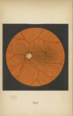Fig. 1. Fond d'oeil normal - Atlas manuel d'ophtalmoscopie