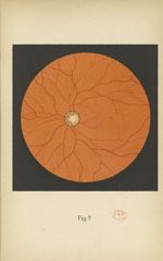 Fig. 2. Fond d'oeil normal - Atlas manuel d'ophtalmoscopie