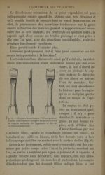 Fig. 6. - Rugines tranchantes d'Ollier permettant le détachement complet du périoste avec sa couche  [...]