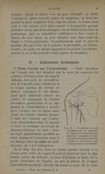 Fig. 13. - Projection du nerf circonflexe sur le squelette de l'épaule en vue postérieure - Traiteme [...]