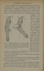 Fig. 39. - Manière de commencer le travail de flexion active - Traitement des fractures. T. 1 : Frac [...]
