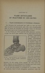 Fig. 76. - Séton par balle au ras du calcanéum en avant du tendon d'Achille - Traitement des fractur [...]