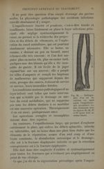 Fig. 26. - Radiographie d'un cal du cubitus, six mois après l'esquillectomie secondaire totale - Tra [...]