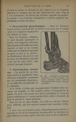 Fig. 151. - Fracture de l'extrémité inférieure des os de la jambe - Traitement des fractures. T. 2 : [...]