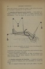 Fig. 69. - Attelle articulée de Leriche - La suspension dans le traitement des fractures : appareils [...]