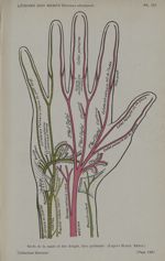 Pl. III. Nerfs de la main et des doigts, face palmaire (d'après Henry Meige) - Formes cliniques des  [...]