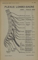 Pl. VIII. Schéma Henry Meige - Formes cliniques des lésions des nerfs 