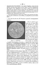 (Fig. 1.). - Oeil droit - Bulletin général de thérapeutique médicale et chirurgicale