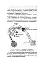 Schéma pathogénique de la migraine ophtalmique : voie centripète ; centres ; voie centrifuge se rend [...]