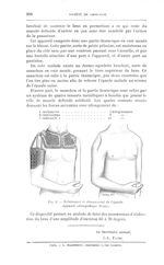 Fig. 2. — Éclatement et désossement de L’épaule. Appareil orthopédique (Pozzi) - Bulletins et mémoir [...]