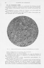 Fig. 2. — Région du Schwannome envahie par des fibroblastes sarcomateux - Mémoires de l'académie de  [...]