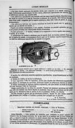 [Strabotomie] - L'Union médicale : journal des intérêts scientifiques et pratiques, moraux et profes [...]