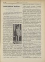 Fig. XVII. Malade de l'observation XI (Madelung) - Gazette des hôpitaux civils et militaires (Lancet [...]