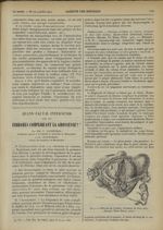 Fig. 4. Fibrome de l'utérus. Grossesse de deux mois (Bender. Thèse Burty, 1907) - Gazette des hôpita [...]