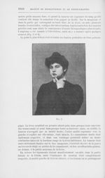 Fig. 5 [Angiomes des lèvres par M. Morestin] - Annales de dermatologie et de syphiligraphie