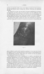 Fig. 6 [Nouvelle contribution à l'étude du phagédénisme géométrique par L. Brocq] - Annales de derma [...]