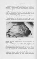 Fig. 4 [Recherches sur la “ fausse teigne amiantacée ” - La vraie fausse teigne amiantacée d'Alibert [...]