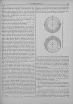 Fig. 73. - Champ visuel, amaurose complète de l'oeil gauche - Le progrès médical  : journal de médec [...]