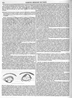[Reconstruction des paupières] - Gazette médicale de Paris : journal de médecine et des sciences acc [...]