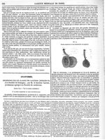 Fig. 4. Glandes muqueuses ou sous-conjonctivales des paupières - Gazette médicale de Paris : journal [...]