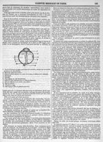 [Décollement de la rétine avec double pédicule] - Gazette médicale de Paris : journal de médecine et [...]