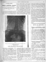 Fig. 1. Cliché sur bois d'après épreuve obtenue par M. le Dr Aubourg avec les sondes urétérales du D [...]