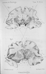 Planche 4. Fig.1. Coupe transversale des hémisphères cérébraux, faite à 1 centimètre en arrière du c [...]