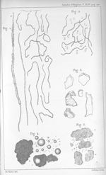 Fig. 1. Eléments nerveux cérébraux desséchés, puis ramollis dans l'eau / Fig. 2. Cylindres et globul [...]