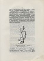 Fig. 7. Cas d'Hillairet. Constructions du tronc et du cou par des circulaires du cordon - Des dispos [...]