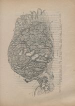 Figure V. Coupe d'un cancer de la portion vaginale à son début - Du cancer Utérin pendant la grosses [...]