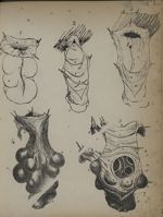 Planche II - Recherches sur les causes et l'anatomie des hernies abdominales ; thèse soutenue pubiqu [...]