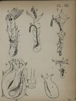 Planche III - Recherches sur les causes et l'anatomie des hernies abdominales ; thèse soutenue pubiq [...]