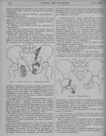 Fig. 2. Observation n° 1 : radiographie tardive / Fig. 3. Observation n° 2 - Revue générale de clini [...]