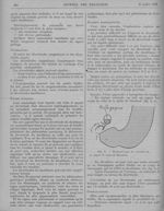 Fig. 2. Diverticules du duodénum. a) Aspect de niche de Hawdeck - Revue générale de clinique et de t [...]