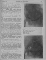[Diagnostic du placenta praevia, par les Drs J. Courtois..., et J. Torlet...] - Revue générale de cl [...]