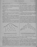 Fig. 1. Coupe schématique d'un adénome / Fig. 2. Coupe schématique d'un polype - Revue générale de c [...]