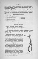 Fig. 1. Speculum bivalve d'Itard - Revue mensuelle de laryngologie, d'otologie et de rhinologie