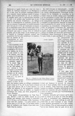 Fig. 5. - Femme de race Bobo (Haute Volta), en état de grossesse avancée, revenant des champs - Le C [...]