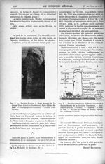 Fig. 2. - Menhir-Statue à Buste humain de La Grosse Terre (Corniche Vendéenne), Saint-Hilaire-de-Rie [...]