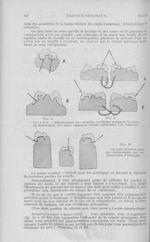 Fig. 8 et 9. — (Décollements sur vulcanite), les fléches indiquent les zones de décollement. Les den [...]