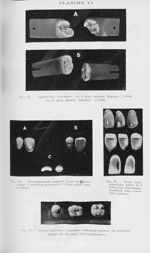 Fig. 24. — Eprouvettes acryliques : en A diato molaire. Rupture : 4k600. En B, dialo molaire. Ruptur [...]