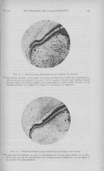 Fig. 4. — Réaction des phosphatases sur l'organe de l’ivoire / Fig. 5. — Réaction témoin sans incuba [...]