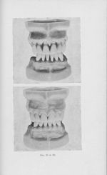 Fig. 27 / 28 - L'Odontologie