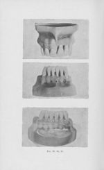 Fig. 29 / 30 / 31 - L'Odontologie