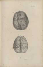 Pl. CCXXIV. Fig. 1. - Face supérieure du cerveau, dont les veines, injectées et distendues avec de l [...]