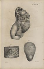 Pl. CCLXXXIV. Fig. 1. - L'utérus dans l'état de grossesse, avec les viscères de l'abdomen. Côté droi [...]