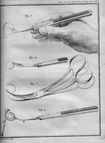 Planche XIX. Fig. 1. Une aiguille pointue, tranchante & demie courbée, ayant la forme d'une lancette [...]